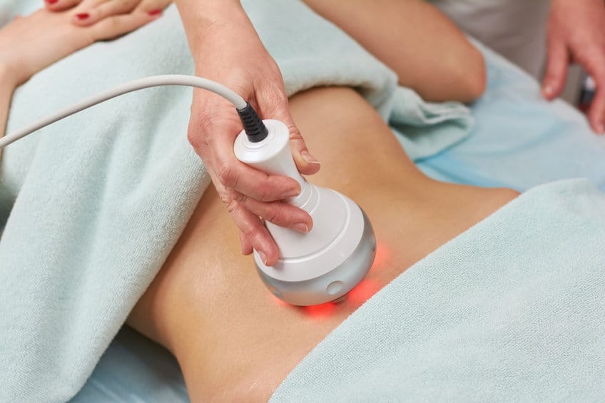 Radio frequency skin tightening machine. Radio frequency skin tightening machine. Belly of a woman, cosmetology.